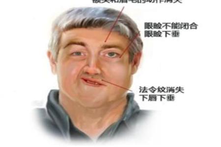 面相中的歪嘴象征着什么？一探究竟