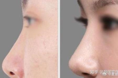 鼻梁低的面相如何影响个人运势与性格特点