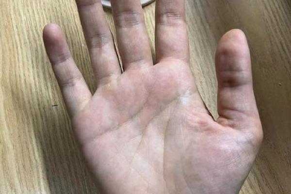 掌纹中的机遇纹：如何利用手相抓住未来的机会
