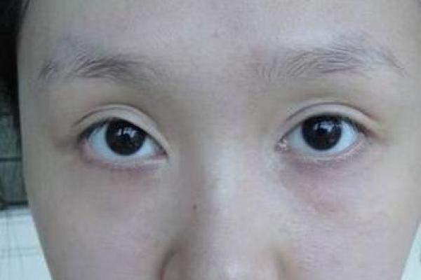 如何通过歪嘴面相识别一个人的潜在性格