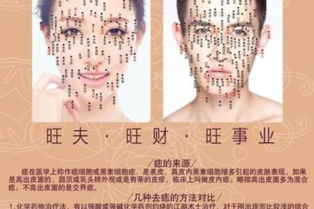 痣相与财富运势：哪些痣相预示大富大贵