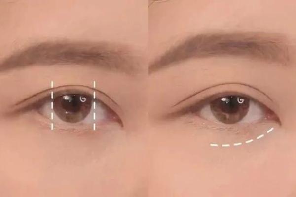黑眼圈面相解析：如何通过眼部特征看出健康状况与性格特点