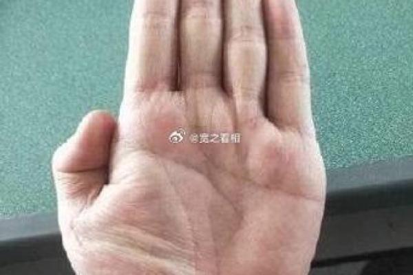 手相金星丘出现横纹的深层含义