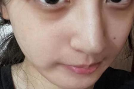 黑眼圈面相解析：如何通过眼部特征看出健康状况与性格特点