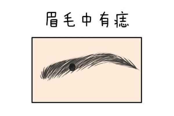 头部长痣代表什么？解析头顶痣相的不同类型