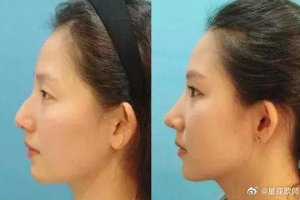 鼻翼宽面相与财富运势的关系探讨