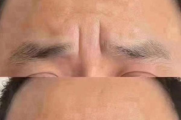 抬头纹与面相解析：如何通过额头皱纹看出性格与运势