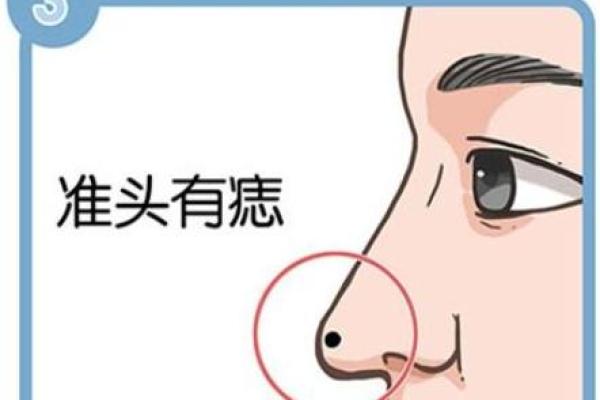 长在旺夫相位置的痣，能为婚姻带来哪些影响