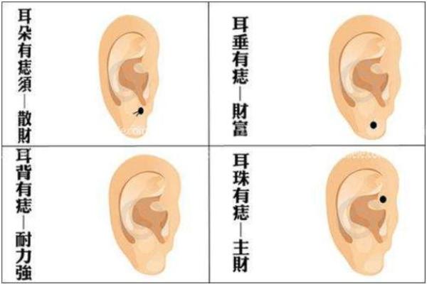通过痣相分析，了解女人的性格和未来趋势