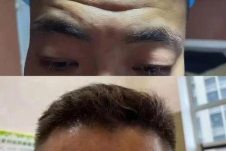 如何通过面相中的抬头纹判断生活中的挑战