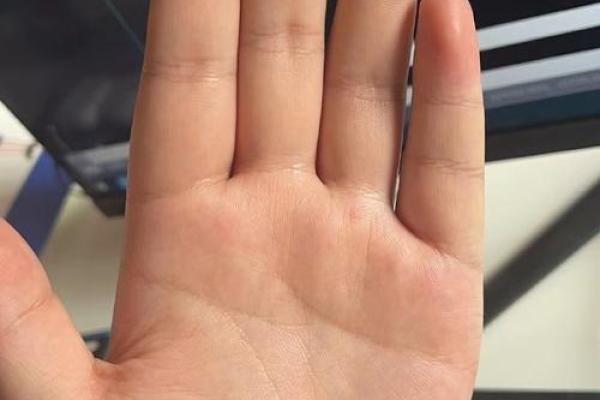 手相中的肠胃线如何影响消化系统