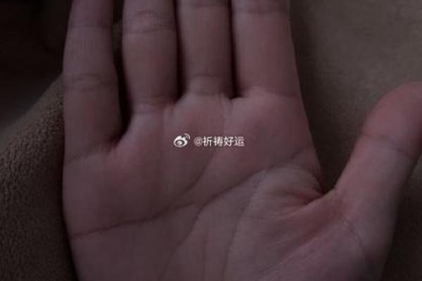 手掌白痕象征的命运暗示与个性解析