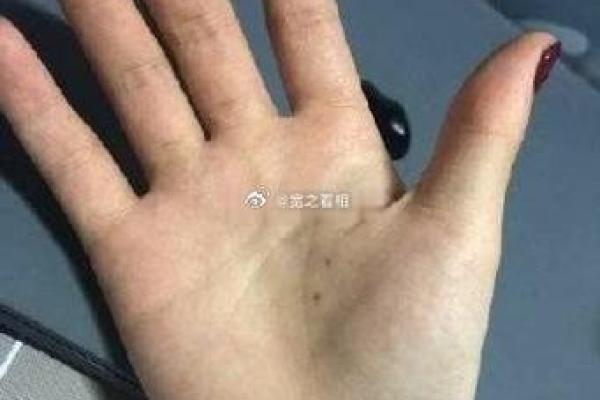 手掌白痕象征的命运暗示与个性解析