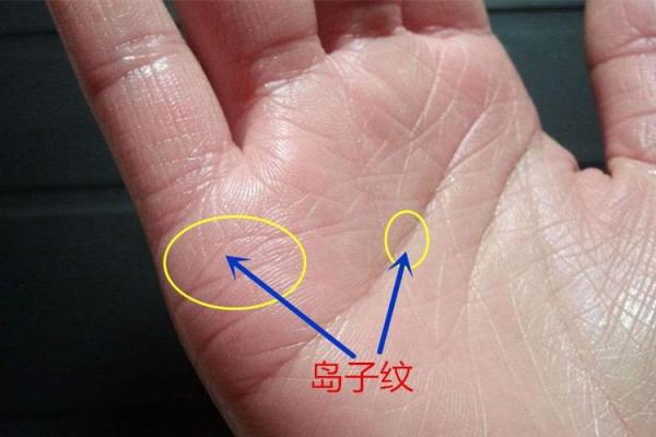 手相中出现红点的含义与解读