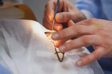 割双眼皮与命理：改变外貌是否影响个人运势