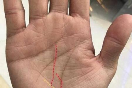 手相中出现红点的含义与解读