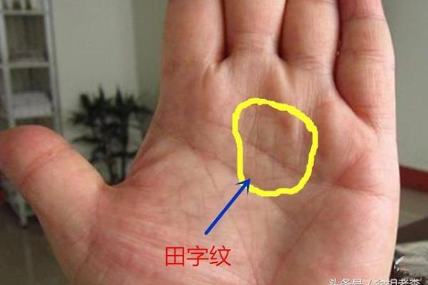 了解手相黑子纹的象征意义及对人生的影响