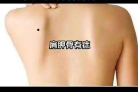 如何通过痣相辨别杀子运势