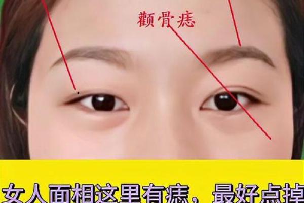 痣相不好怎么办 简单有效的改善技巧