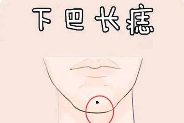 你身上的痣相透露了什么人生秘密