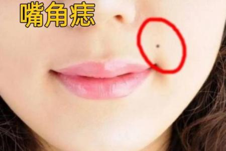 痣相分析是否准确？揭秘传统与现代观念的差异