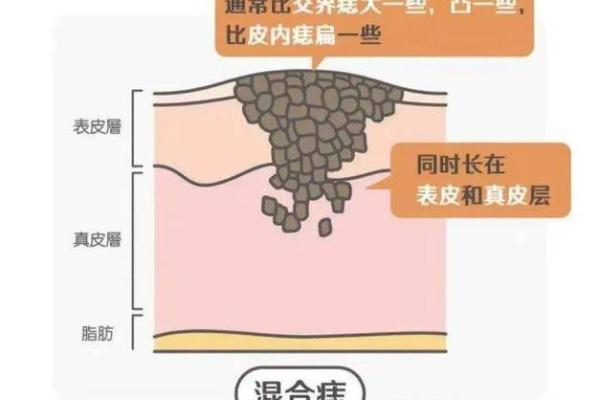 项痣相解析：如何通过项部痣相判断性格与运势