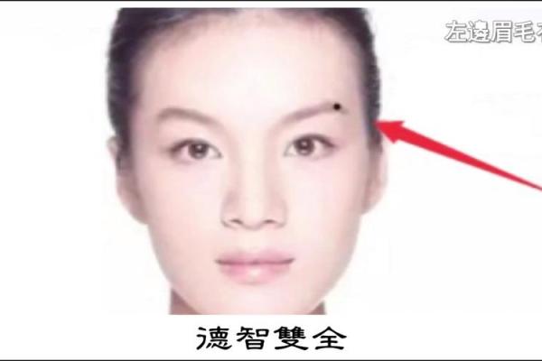 旺夫相的痣能带来好运吗