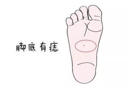 脚底痣相的含义与命运解读