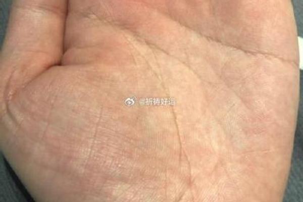 揭秘鹿晗手相中的命运密码