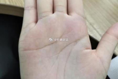 揭秘胃癌的手相特征：通过掌纹分析健康隐患