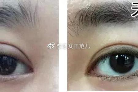 命理学视角下的割双眼皮：是否能改变人生运势