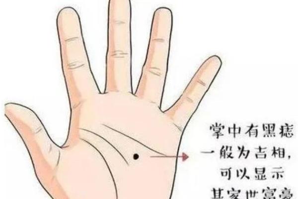 手心痣相图解：从手掌看你未来的运势与性格