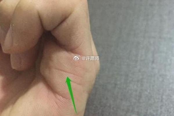探索手相医学的奥秘与应用