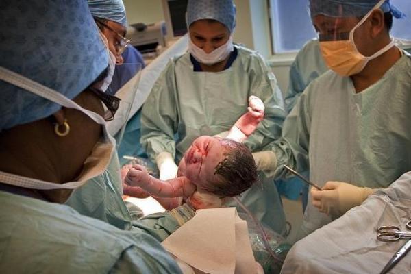 剖腹产出生的孩子生辰八字是否准确分析