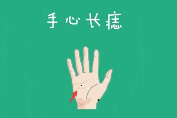 手心有痣？揭秘不同位置的痣相与命运暗示