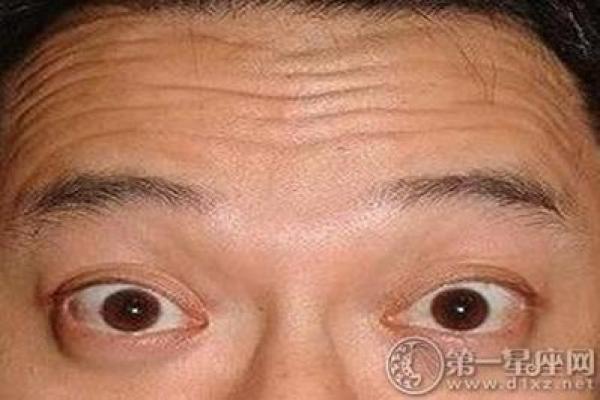 面相分析：抬头纹反映的性格和心理暗示