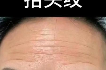 面相分析：抬头纹反映的性格和心理暗示