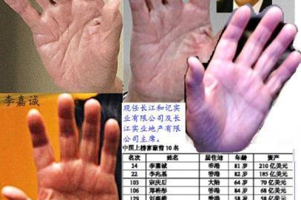 医学手相学：手掌线条背后的疾病预警信号