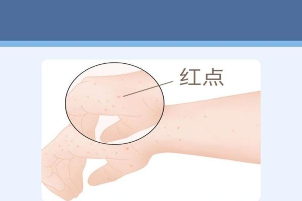 解密手相中的红点：预示着什么样的生活走向？