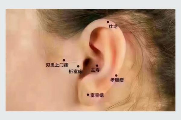 石崇痣相解析：如何通过痣的位置看出命运走势