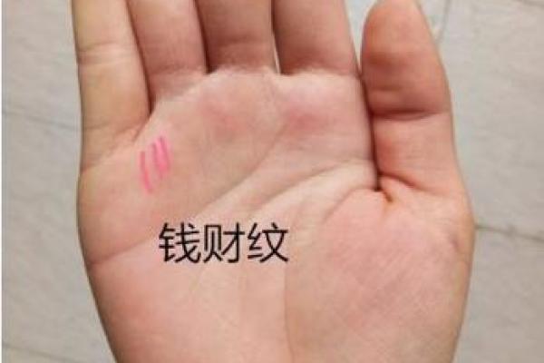 手相黑子纹解析：影响你命运的微小标志