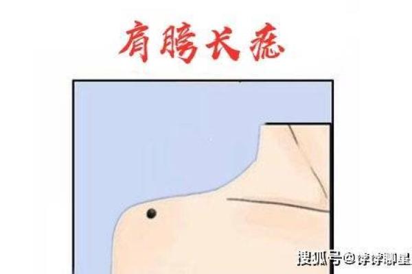 肩膀上的痣相与命运的关系分析
