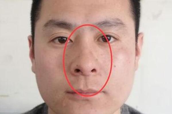 鼻型面相与运势：从鼻子看你的财富与健康走势