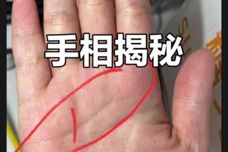 手上痣相与性格运势的关系