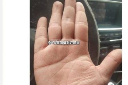 手相解读：肠胃健康的早期警示