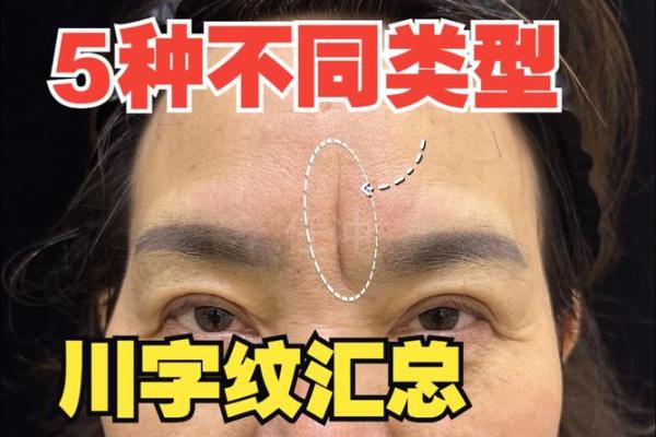 川字纹的面相解析与命运关系探讨