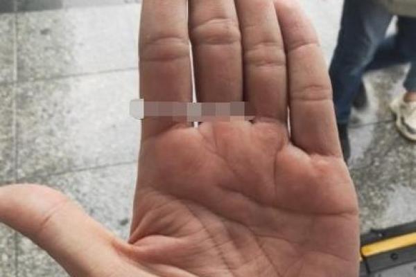 金星丘横纹多的手相象征着什么