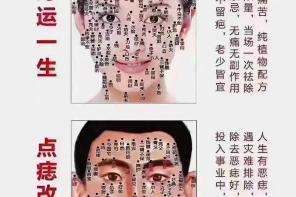 如何通过痣相了解你的性格和未来