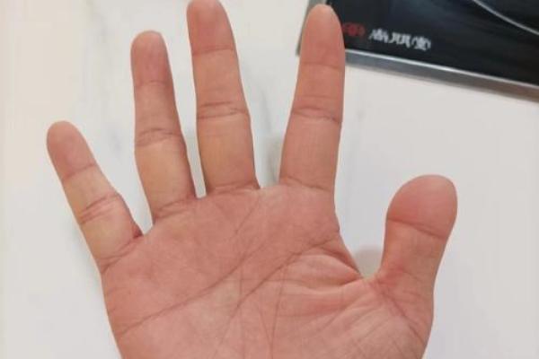 金星丘横纹揭示的性格与命运特征