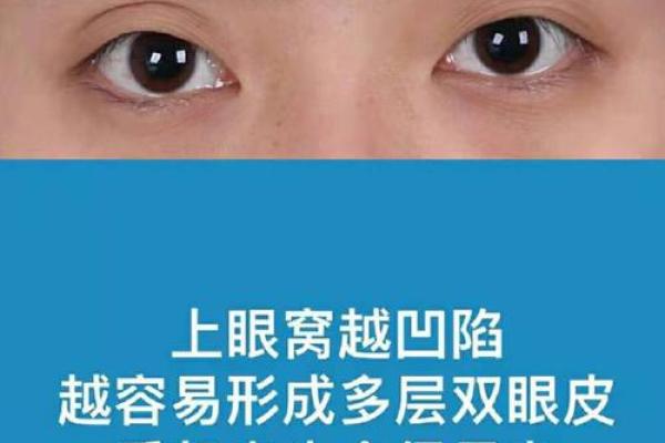 眼窝凹陷预示婚姻坎坷？揭秘面相与婚姻的神秘联系